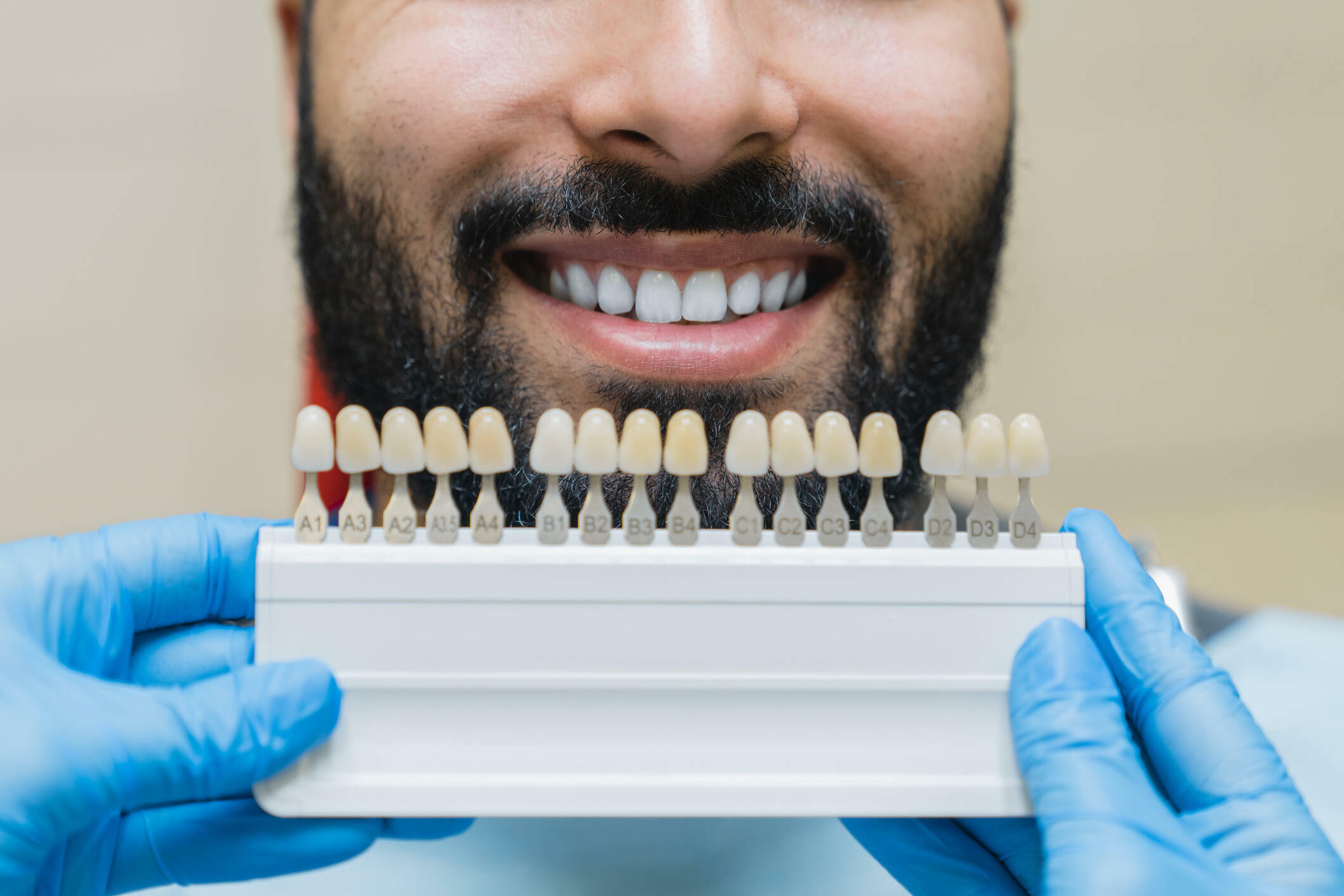 How to Find the Best Porcelain Veneers in Kansas City_FI