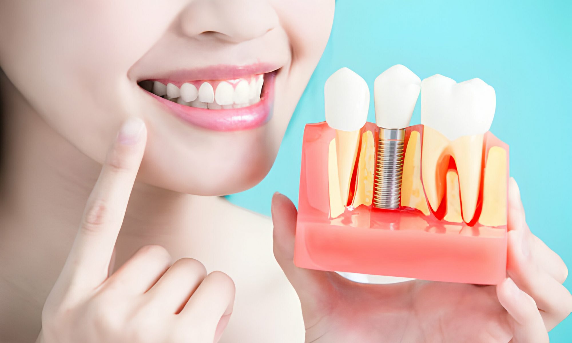 Securing Your Smile: A Guide On How To Fix Loose Dental Implants_FI