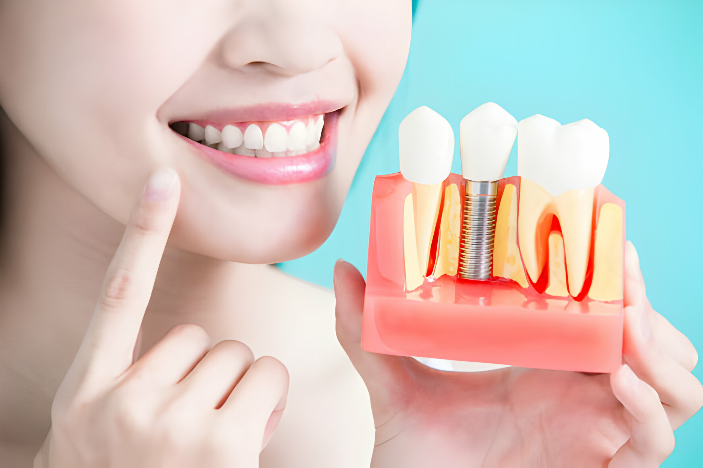 Securing Your Smile: A Guide On How To Fix Loose Dental Implants_FI