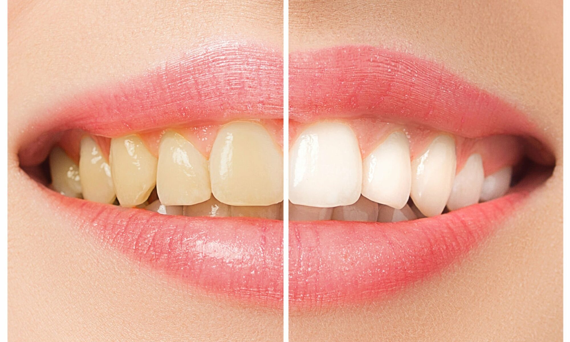 Is Cosmetic Dentistry Kansas City Worth The Investment?_FI