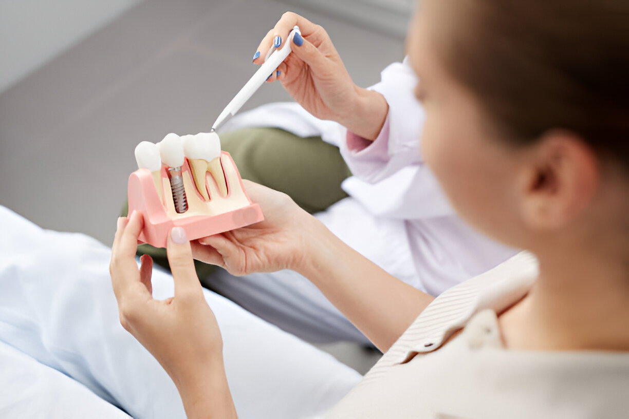 Maintaining Your Dental Implants for a Lifetime in Prairie Village, KS