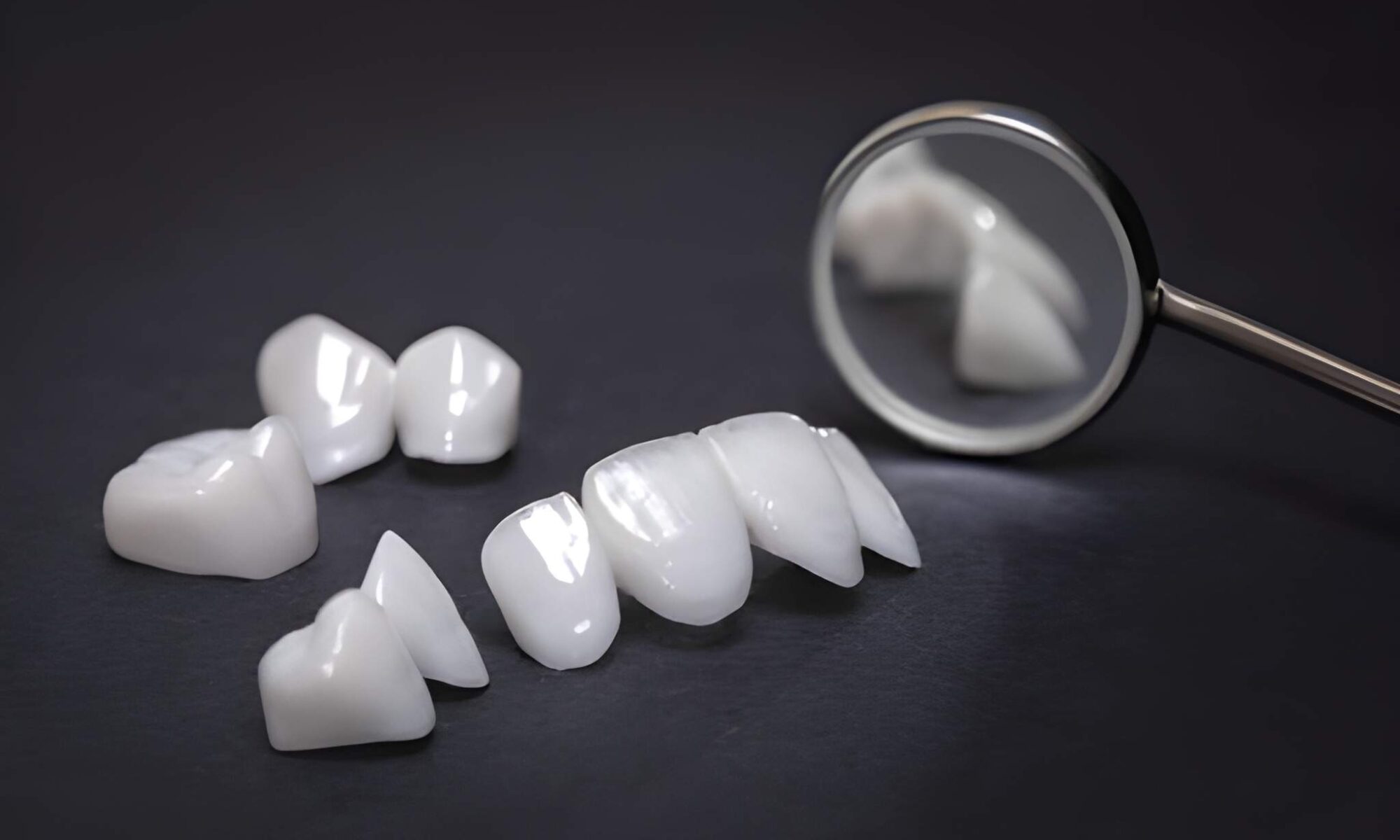 Fillings vs. Crowns: Which Restorative Option Is Right for You? Expert Advice from Cope Dentistry_FI